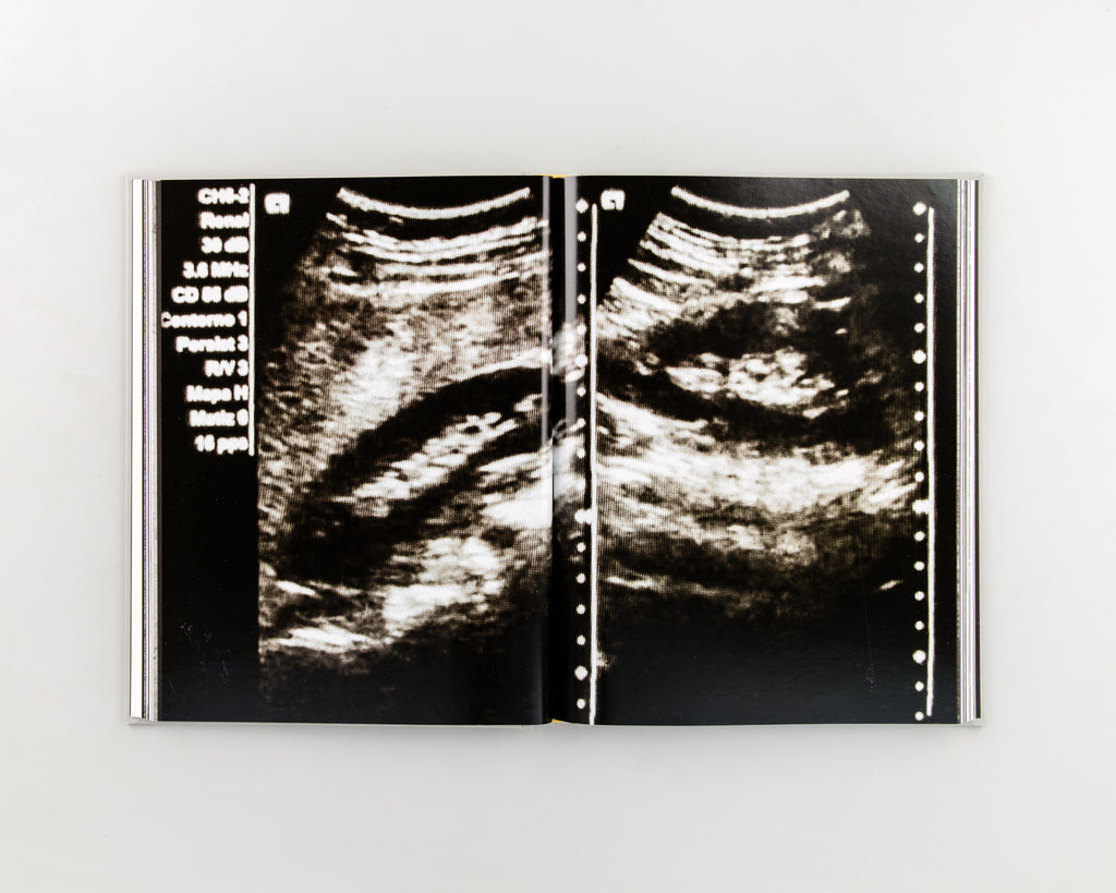 On Abortion by Laia Abril - 3