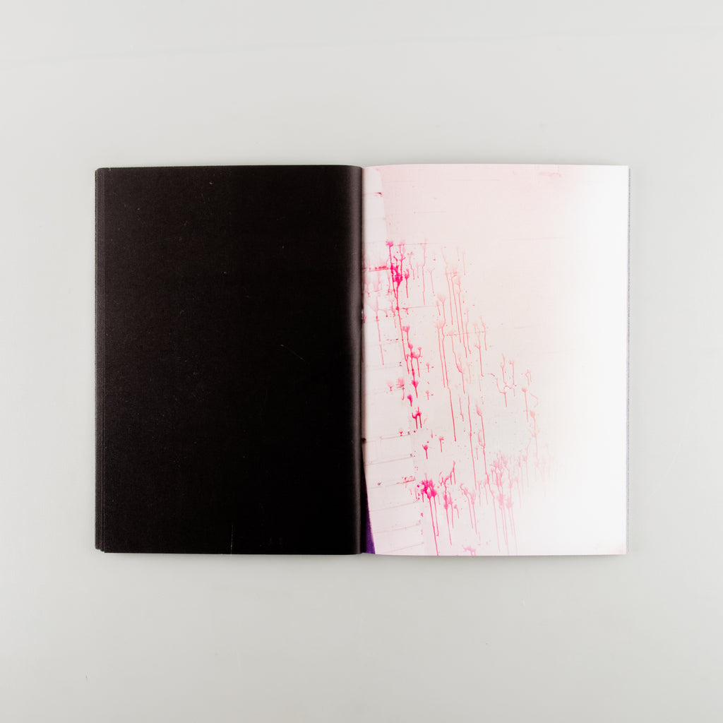 Stop the Bleeding by Liam Dobbin - 7